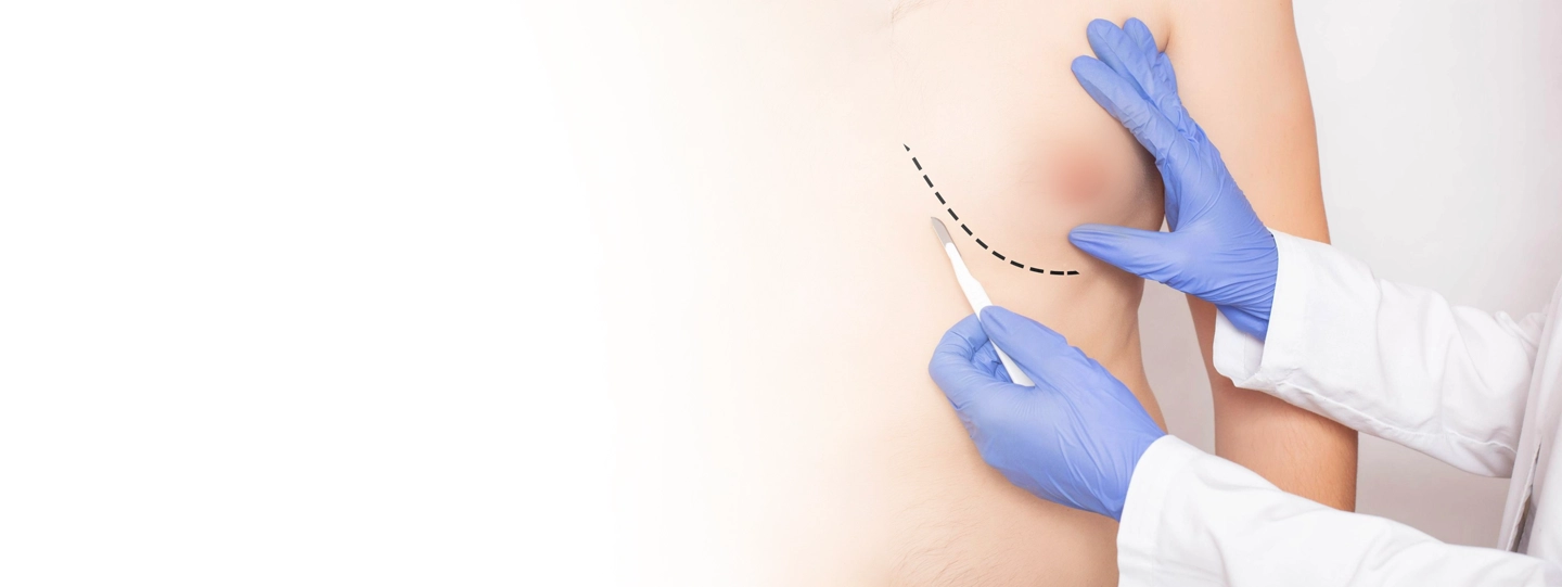 Gynecomastia Surgery Cost in Pune: A Complete Guide